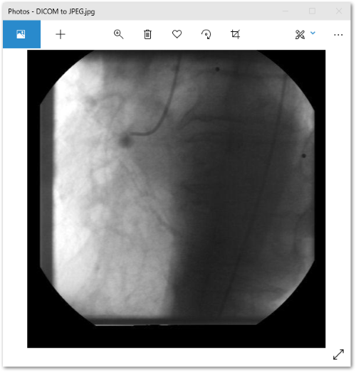 Convert DICOM to JPEG C#